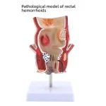 Large Intestine Pathology Model Silicone Organ and Head Model for Gastrointestinal and Colon Disease Anatomy Training