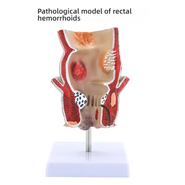 Large Intestine Pathology Model Silicone Organ and Head Model for Gastrointestinal and Colon Disease Anatomy Training