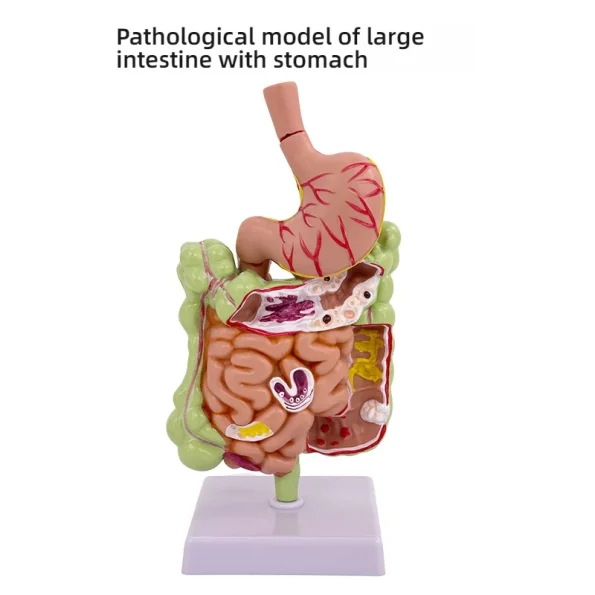 Large Intestine Pathology Model Silicone Organ and Head Model for Gastrointestinal and Colon Disease Anatomy Training