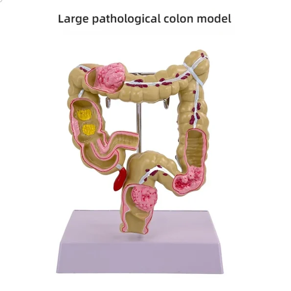 Large Intestine Pathology Model Silicone Organ and Head Model for Gastrointestinal and Colon Disease Anatomy Training