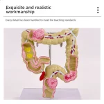 Large Intestine Rectum Disease Specimen Model for Medical Education Plastic Teaching Colon Pathology Tool for Doctor-Patient