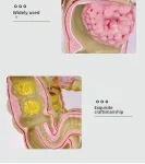 Large Intestine Rectum Disease Specimen Model for Medical Education Plastic Teaching Colon Pathology Tool for Doctor-Patient