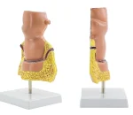 Large Rectal Hemorrhoid Anatomical Model for Medical Education Essential Educational Equipment