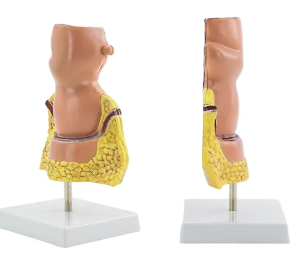 Large Rectal Hemorrhoid Anatomical Model for Medical Education Essential Educational Equipment