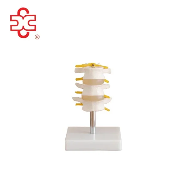 Lumbar Set (3 Pcs) Spine Lumbar Spine