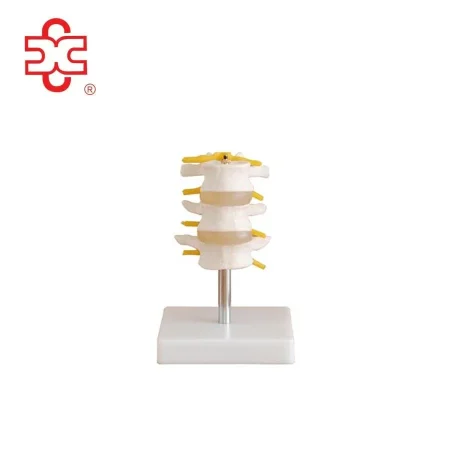 Lumbar Set (3 Pcs) Spine Lumbar Spine