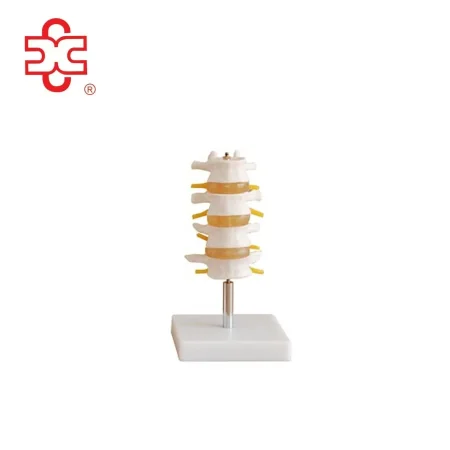 Lumbar Set Spine Lumbar Spine