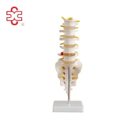 Lumbar Vertebrae with Sacrum & Coccyx and Herniated Disc (Life Size &Mini)