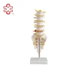 Lumbar Vertebrae with Sacrum & Coccyx and Herniated Disc (Life Size &Mini)