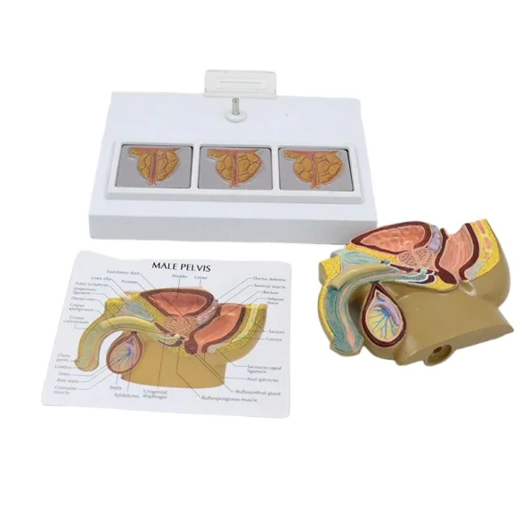 Male Pelvic Cavity Model: Prostate Health & Hyperplasia Stages Demonstration