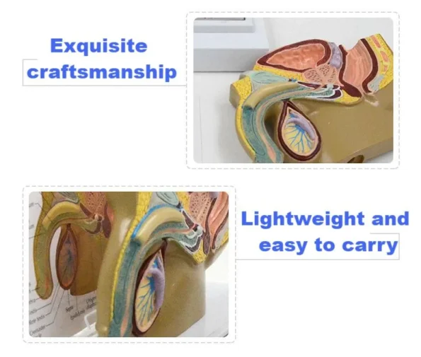 Male Pelvic Cavity Model: Prostate Health & Hyperplasia Stages Demonstration