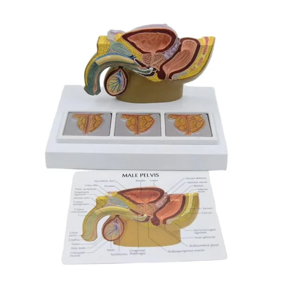 Male Pelvic Cavity Model: Prostate Health & Hyperplasia Stages Demonstration