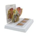 Male Pelvic Cavity Model: Prostate Health & Hyperplasia Stages Demonstration
