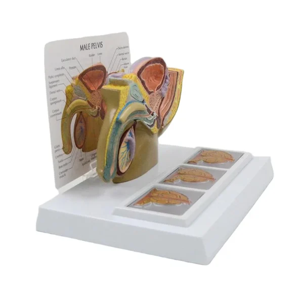 Male Pelvic Cavity Model: Prostate Health & Hyperplasia Stages Demonstration