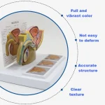 Male Pelvic Cavity Model: Prostate Health & Hyperplasia Stages Demonstration