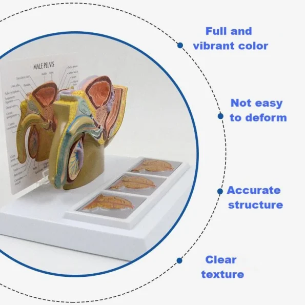 Male Pelvic Cavity Model: Prostate Health & Hyperplasia Stages Demonstration