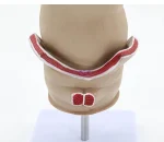Medical Anatomical Hemorrhoid Model for Pathological Demonstration Enhanced Education and Patient Communication