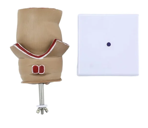 Medical Anatomical Hemorrhoid Model for Pathological Demonstration Enhanced Education and Patient Communication