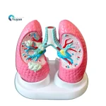 Medical Anatomy Teaching Tool Lung Pathology Vs Normal Comparison Model Educational Equipment