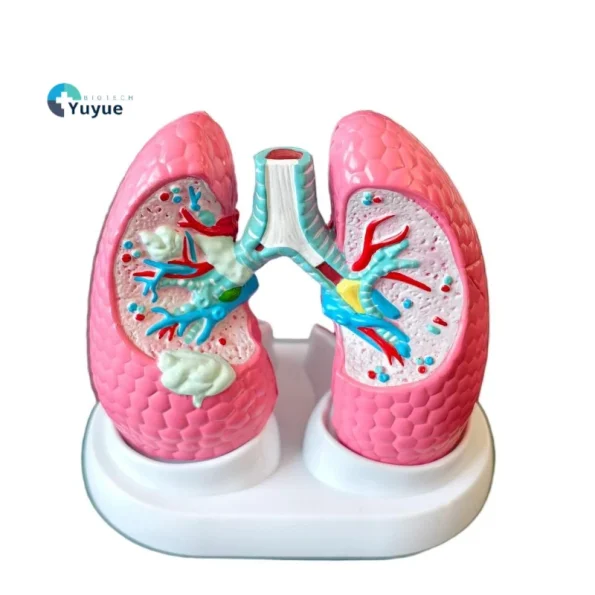 Medical Anatomy Teaching Tool Lung Pathology Vs Normal Comparison Model Educational Equipment