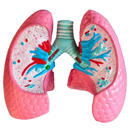 Medical Anatomy Teaching Tool Lung Pathology Vs Normal Comparison Model Educational Equipment