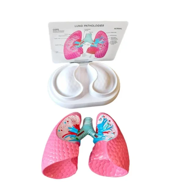 Medical Anatomy Teaching Tool Lung Pathology Vs Normal Comparison Model Educational Equipment