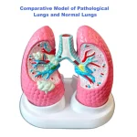 Medical Anatomy Teaching Tool Lung Pathology Vs Normal Comparison Model Educational Equipment