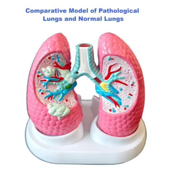 Medical Anatomy Teaching Tool Lung Pathology Vs Normal Comparison Model Educational Equipment