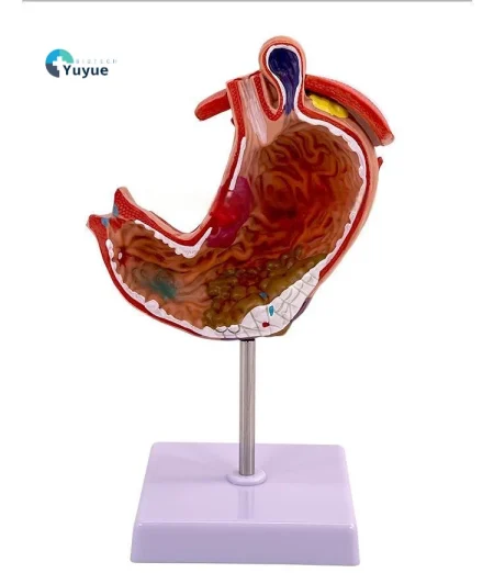 Medical Pathological Stomach Model with Diaphragm | Anatomical Teaching Tool