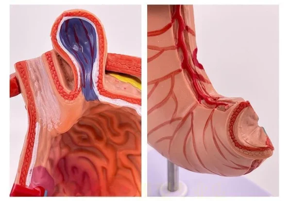 Medical Pathological Stomach Model with Diaphragm | Anatomical Teaching Tool