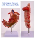 Medical Pathological Stomach Model with Diaphragm | Anatomical Teaching Tool