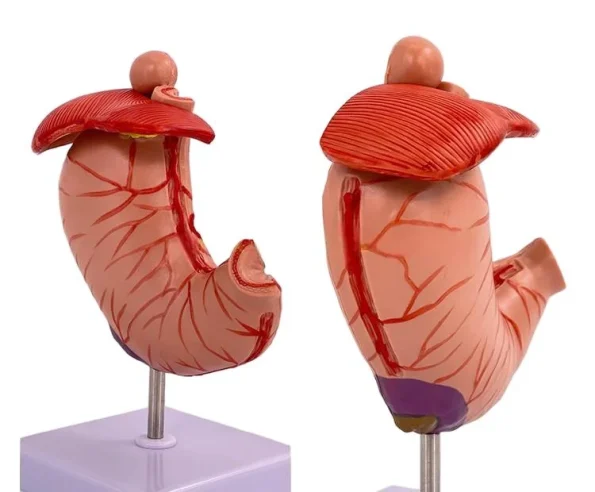 Medical Pathological Stomach Model with Diaphragm | Anatomical Teaching Tool