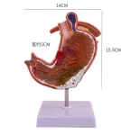 Medical Pathological Stomach Model with Diaphragm | Anatomical Teaching Tool