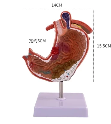 Medical Pathological Stomach Model with Diaphragm | Anatomical Teaching Tool