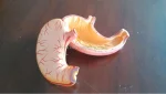 Medical Plastic Stomach Model
