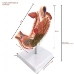Medical Science Education & Demonstration Model Plastic PVC Anatomical Pathological Stomach for Disease Visualization