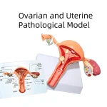 Medical Science Model of Uterine and Ovarian Pathological Lesions