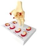 Medical Teaching Model Knee Meniscus Injury Model for Sports Medicine & Anatomy Education