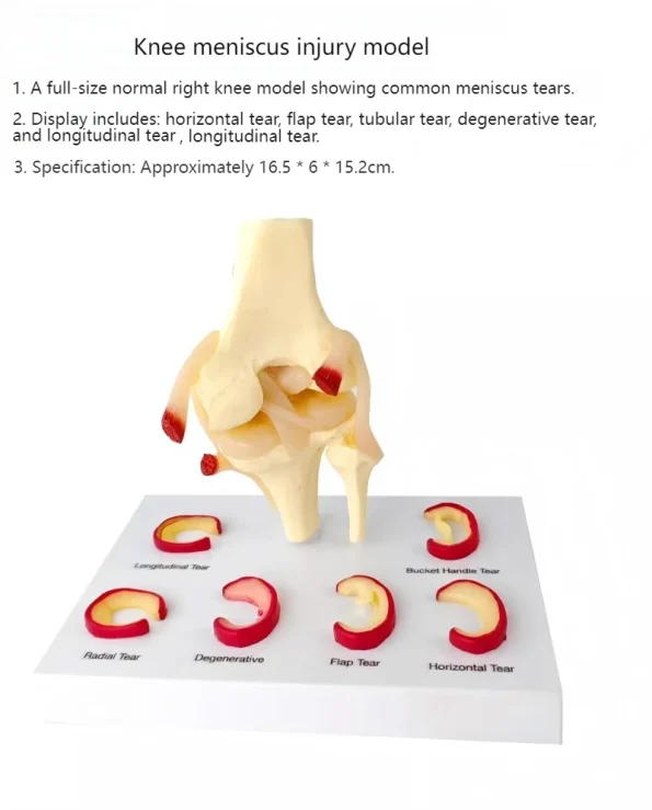 Medical Teaching Model Knee Meniscus Injury Model for Sports Medicine & Anatomy Education