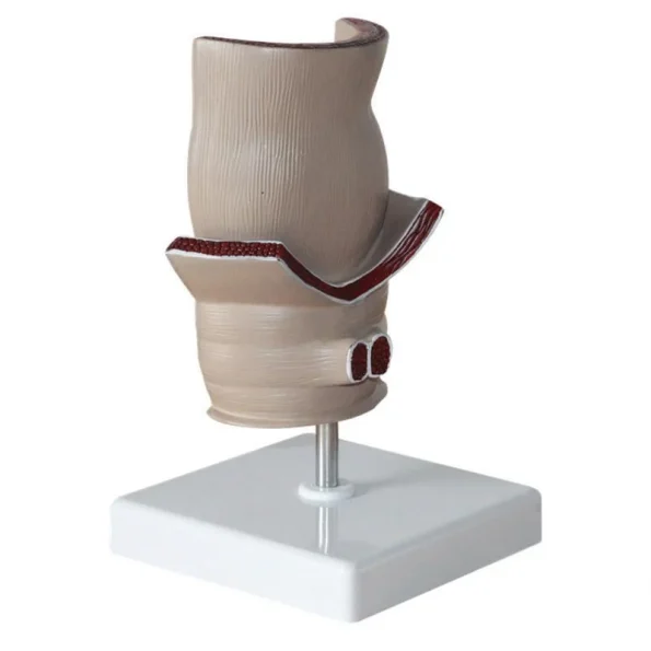 Medical Teaching Model Rectal Pathology Model for Proctology & Anatomy Education