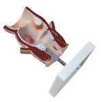 Medical Teaching Model Rectal Pathology Model for Proctology & Anatomy Education