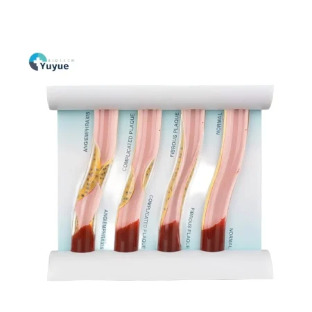 Medical Training Model Blood Lipid Education Anatomical Model PVC Manikin for Medical Science Training for Medical School Use