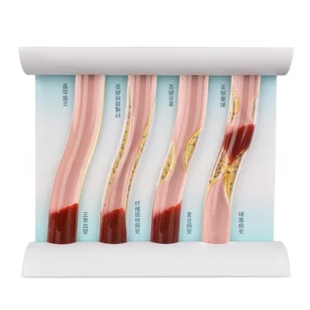 Medical Training Model Blood Lipid Education Anatomical Model PVC Manikin for Medical Science Training for Medical School Use