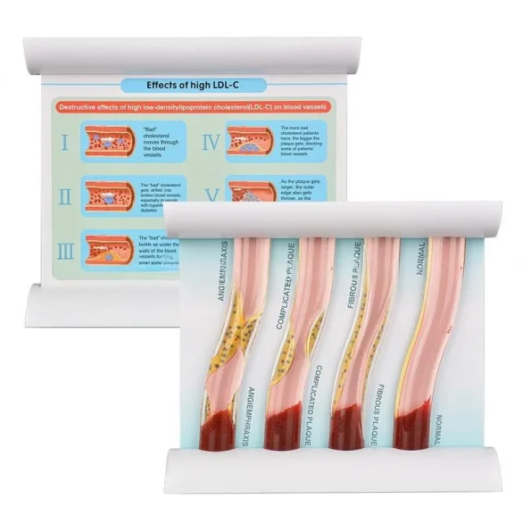 Medical Training Model Blood Lipid Education Anatomical Model PVC Manikin for Medical Science Training for Medical School Use