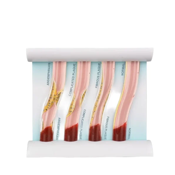 Medical Training Model Blood Lipid Education Anatomical Model PVC Manikin for Medical Science Training for Medical School Use