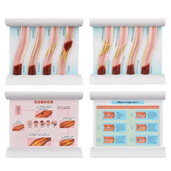 Medical Training Model Blood Lipid Education Anatomical Model PVC Manikin for Medical Science Training for Medical School Use