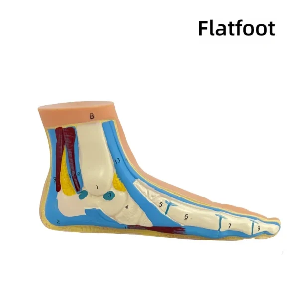 Normal Flat Arched Foot Muscle Anatomy Model with Joint Skeletal Structure for Medical Science
