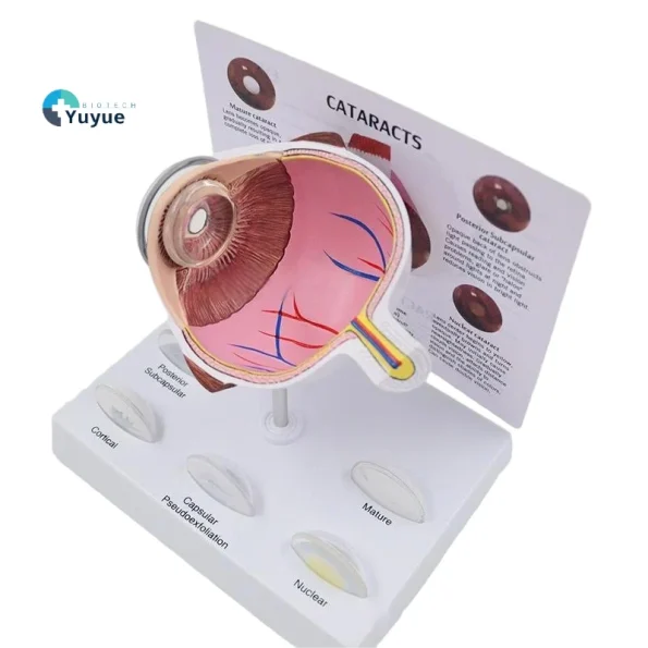Pathological Eye Model with Interchangeable Lenses for Cataract Demonstration