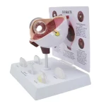 Pathological Eye Model with Interchangeable Lenses for Cataract Demonstration