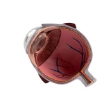 Pathological Eye Model with Interchangeable Lenses for Cataract Demonstration
